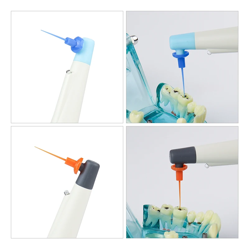 VV Dental Endo Activator Sonic Irrigator 60Pcs Endo Tips Root Canal Debris Cleaning Endodontic Instrument For Dental Clinic