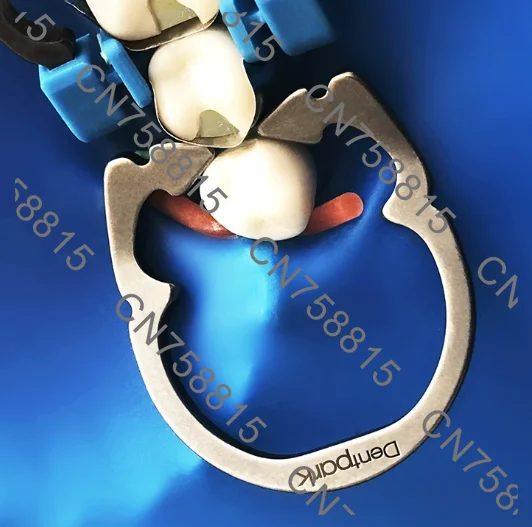 For front and rear tooth wedge retainers, professional stainless steel laboratory tooth separators, fast delivery