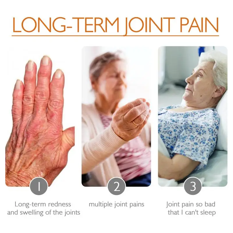 Bee Venom Joint Care Cream Relieves Joint Pain In Hands Feet Bones Lumbar Spine Joints From Prolonged Sitting Body Care Cream