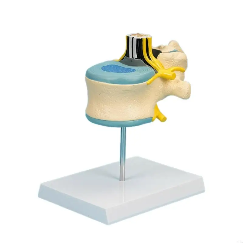 

96BA Human Lumbar Spinal Cord Anatomy Model, Humam Lumbar Vertebra Model