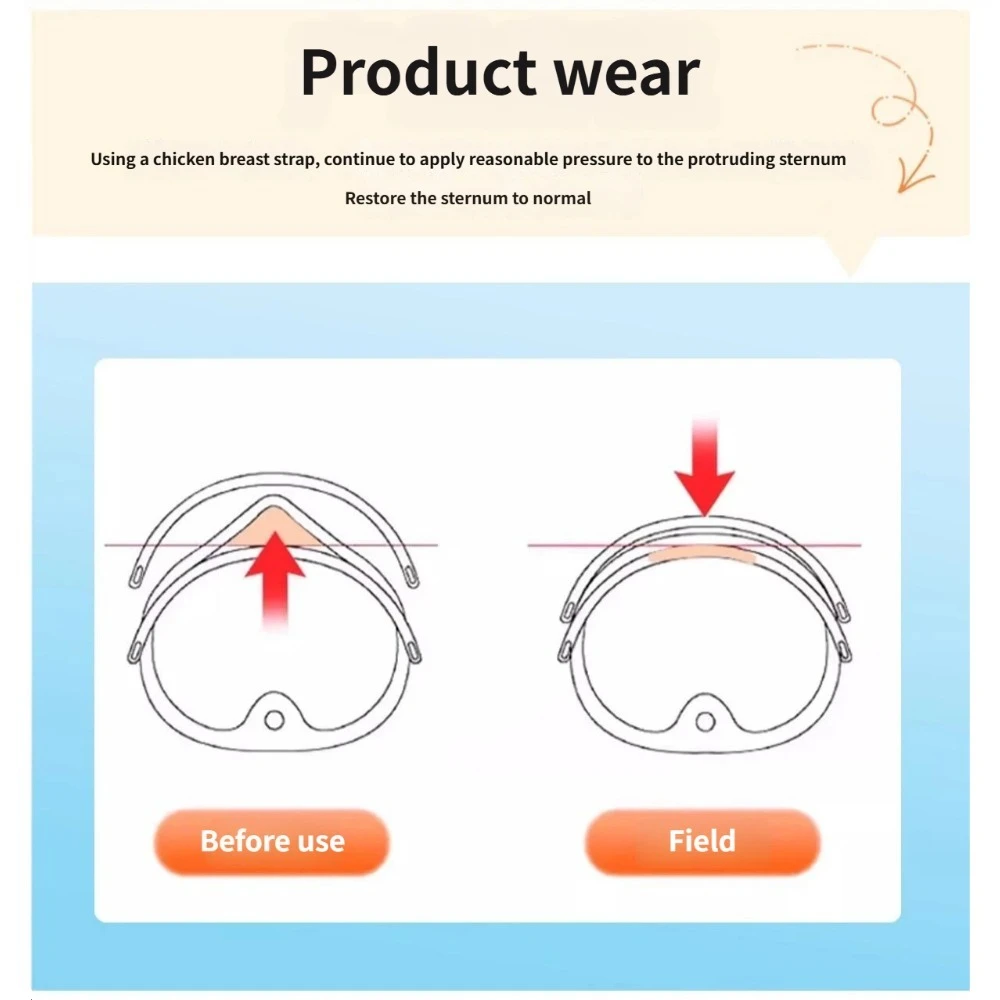 Adjustable Pectus Carinatum Orthosis Brace