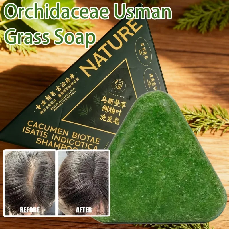 Thumbnail 3 - #42 Latest Hair Loss Treatments Updates