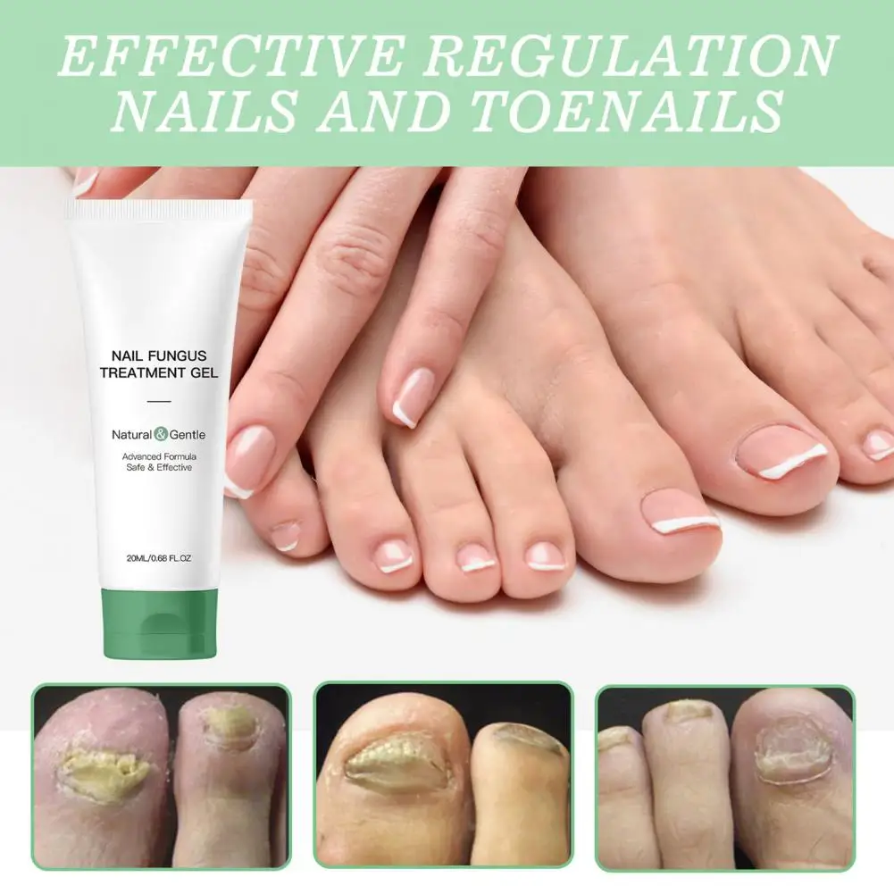 Nail Repair Gel Natural Nail Fungus Treatment Gel for Men Women Hydrating Moisturizing Repair Care Portable Multi-purpose