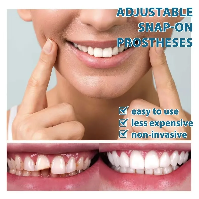 1pcs Adjustable Snap-on Denture Kit｜Instant Teeth Gap Repair & Temporary Crown｜Dental Crowns and Dentures for Protecting Teeth