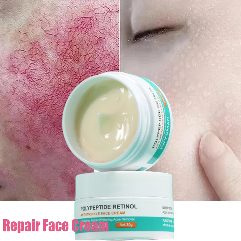 

Facial Redness Repair Cream Improve Sensitive Skin Moisturizer Hydrate Sooth Lotion Removal Rosacea Spider Vein Korean Cosmetic