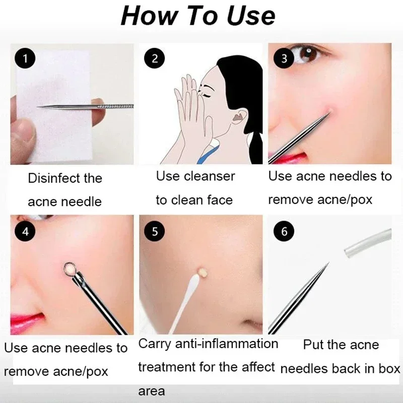 Agulhas para remoção de cravos e acne, 4 unidades, limpador de pontos pretos, cabeça preta, ferramenta de limpeza profunda, ferramenta de cuidados com a pele do rosto