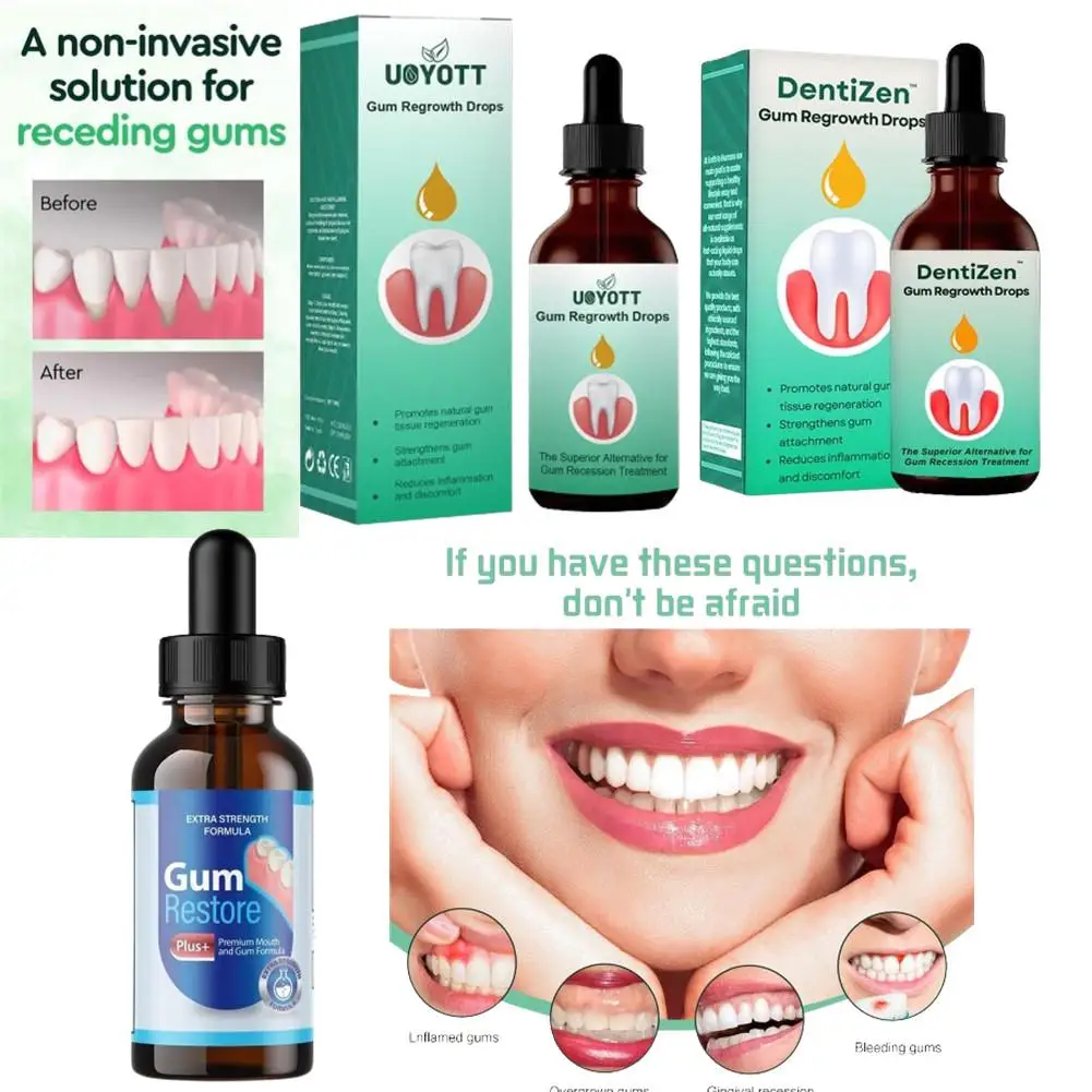 30Ml Gingival Reparatie Druppels Tanden Bleken Vrouwen Mannen Mond Parodontale Gompijn Antibacteriën Behandeling Faryngitis Orale Reiniging