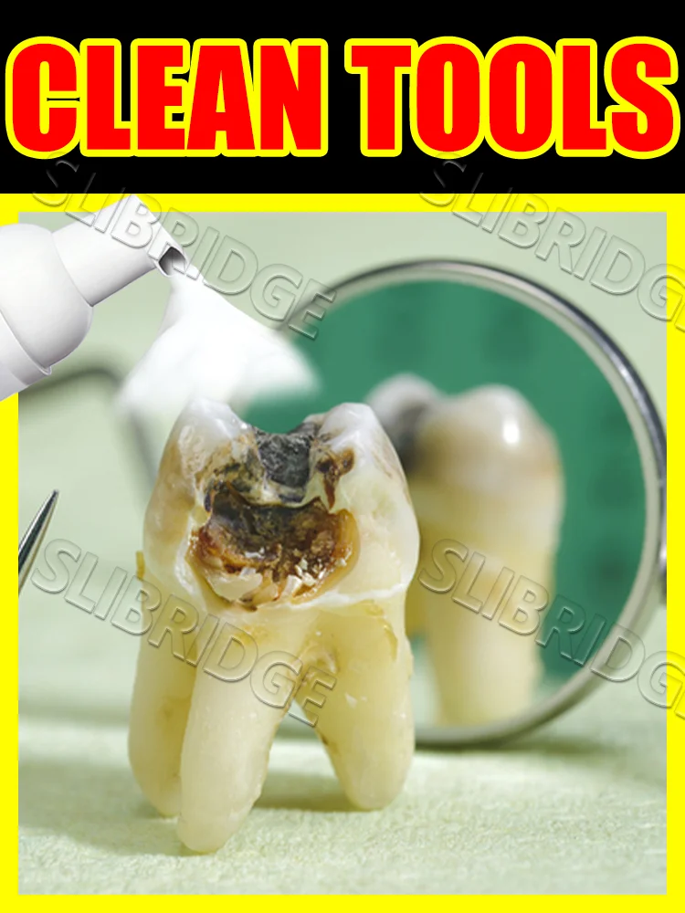 

Free shipping,Exclusive Offer for New Customers,Mousse shield, no way to decay.,Intraoral Mousse clean tools