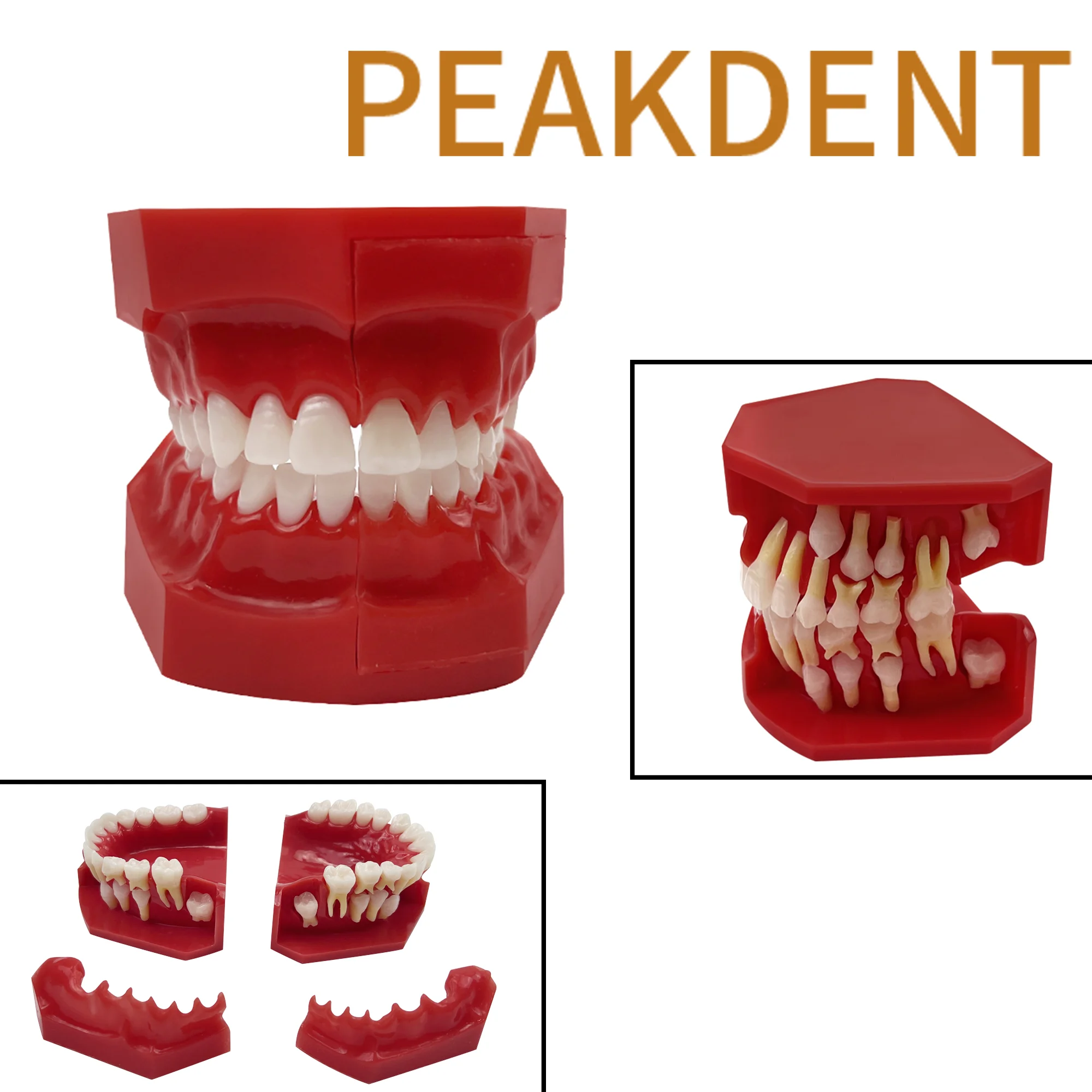 Dental Children 's Deciduous Teeth Replacement Model For Oral Communication  Milk Permanent Teeth Alternately Model Dental Tool