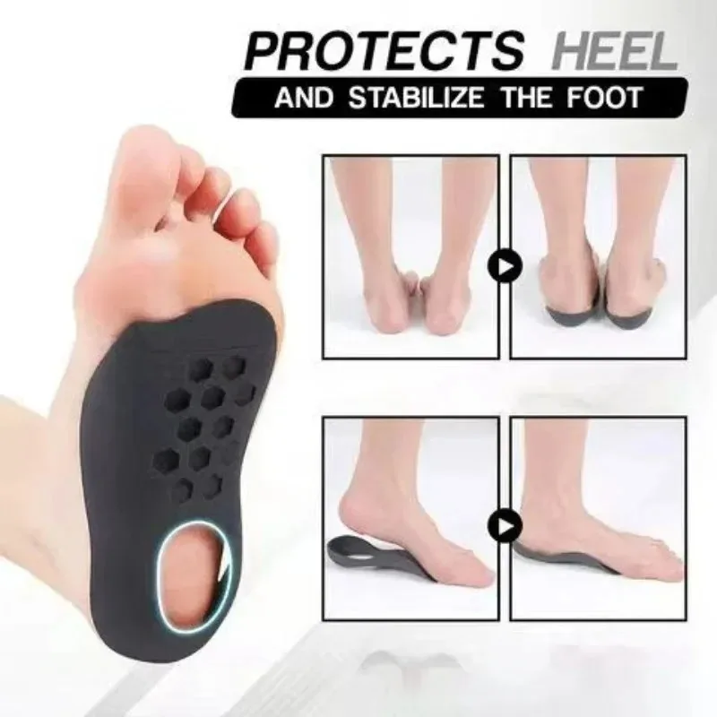 Orthotics Flatfoot Orthotics Cubitus Varus Orthopedic Feet Cushion O-shaped Legs Pads Foot Care Insoles Feet Care