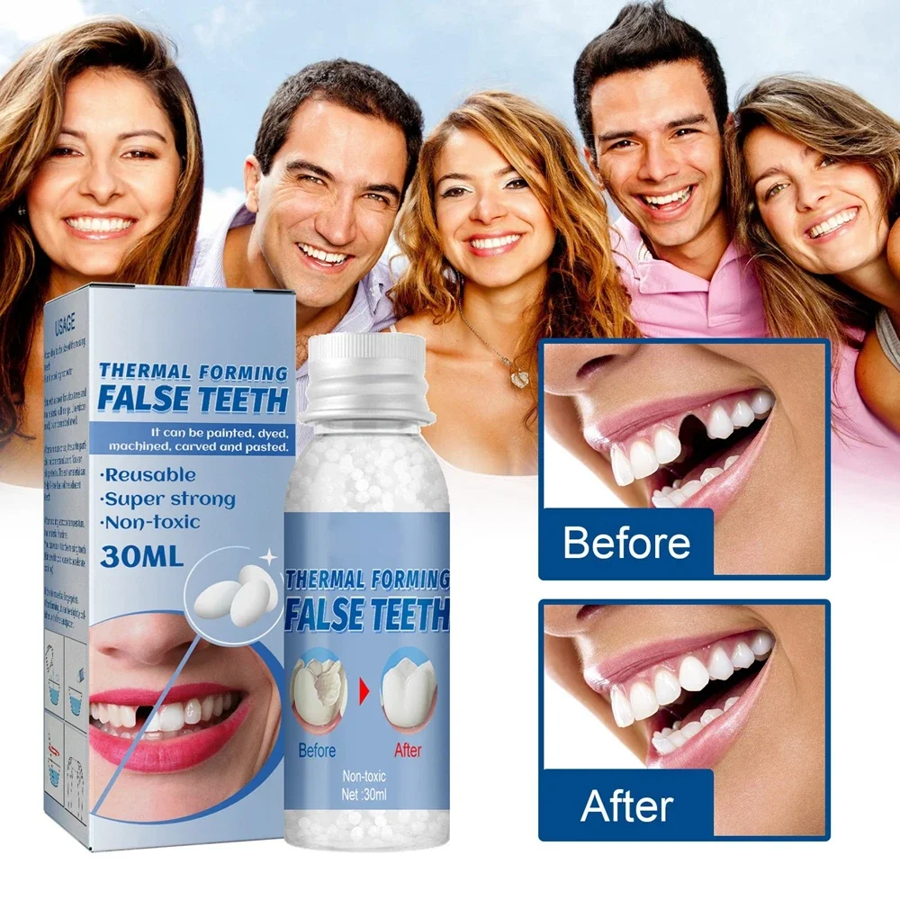 Resin Tooth Repair Glue Shapeable Teeth Fill Gaps Solid Glue Temporary Teeth Repair Falseteeth Glue Dental Beauty Health