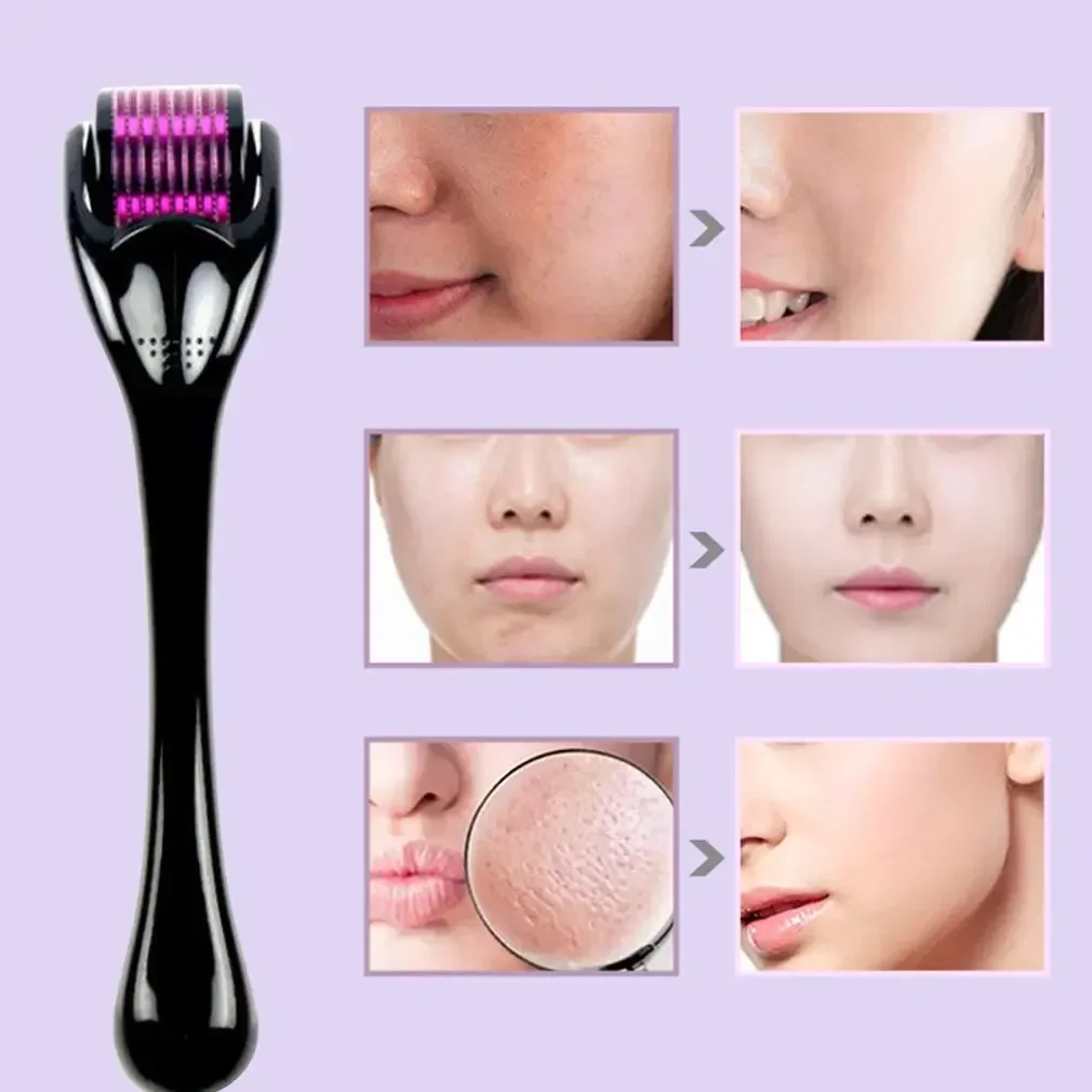 540 Needles for Facial Body Hair Growth Derma Roller for Skin Beard 0.2mm 0.25mm 0.3mm Needle Micro Face Roll Tool view 4