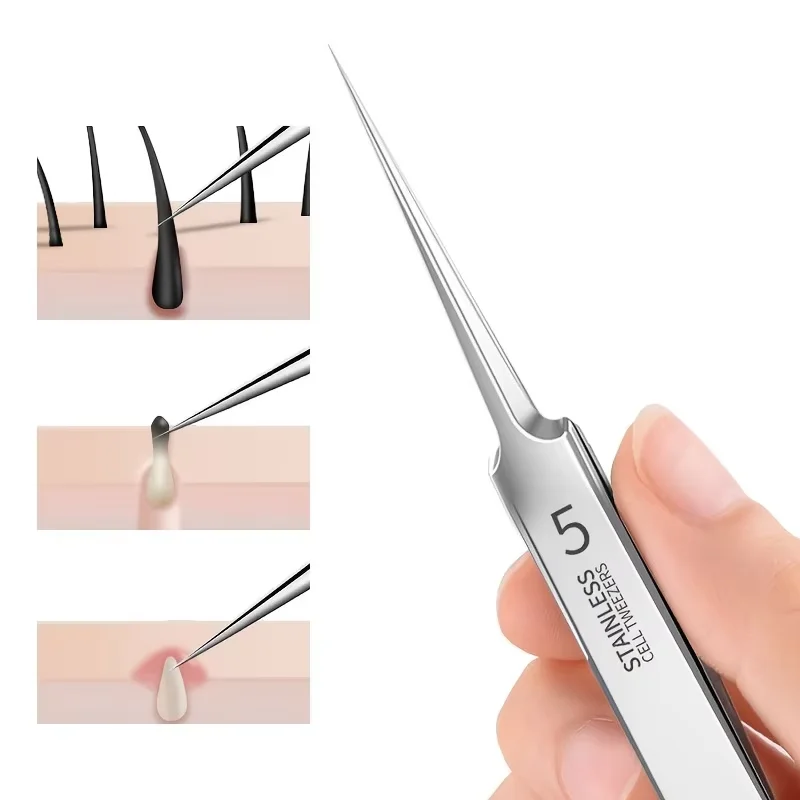 1/3Pcs Extra Fine No.5 Cellular Blackhead Tweezers Facial Acne Remover Needle Tool Precision Pimple Comedone Extractor Clip Tool