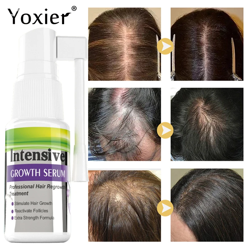 Intensive Growth Serum Spray Treat Hair Loss Deep Nourish Repair Damaged Healthy Oil Control Regrowth Fuller Bushy Scalp Care