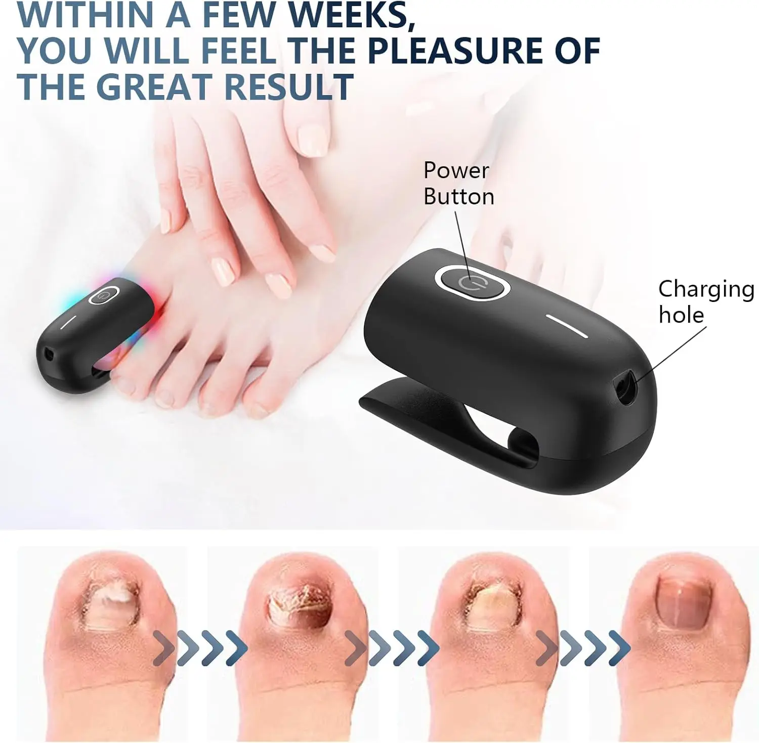 Nail Fungus Laser Device 470nm Blue Light&660nm Red Light&905nm Super Pulsed Invisible Light Smart Remove&Repair Fungal Nail