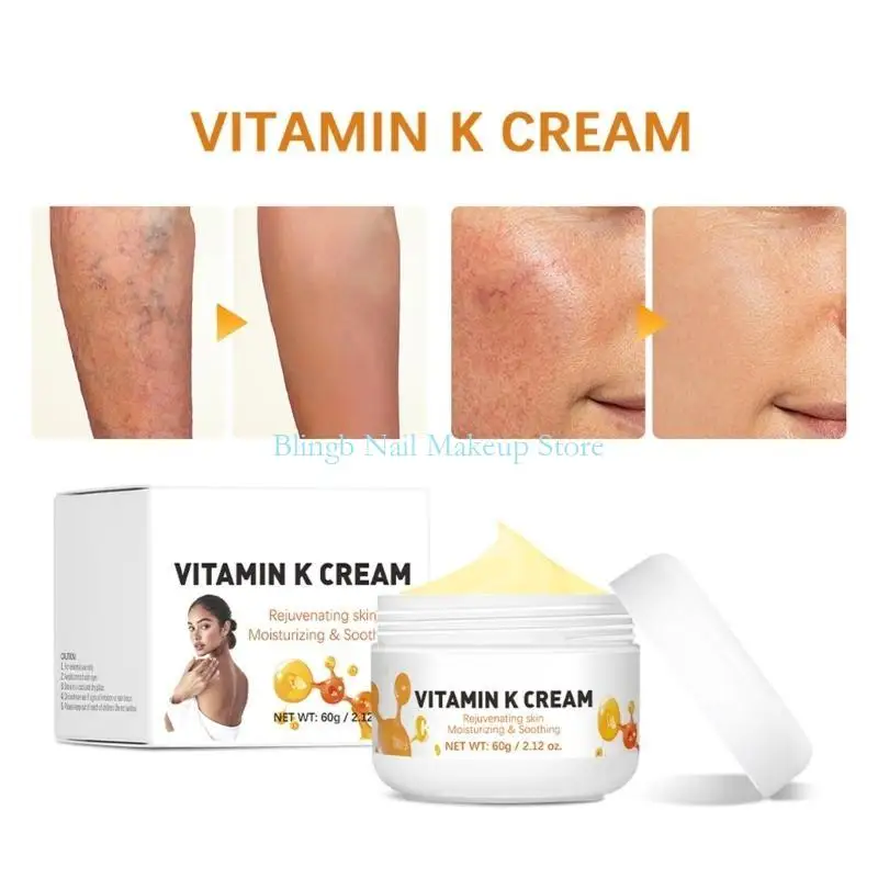 28TA 60g Vitamin K Cream for Bruises,Spiders Veins,Dark Circles,Broken Capillaries,Eyes,and Face Varicose Vein Cream Gifts