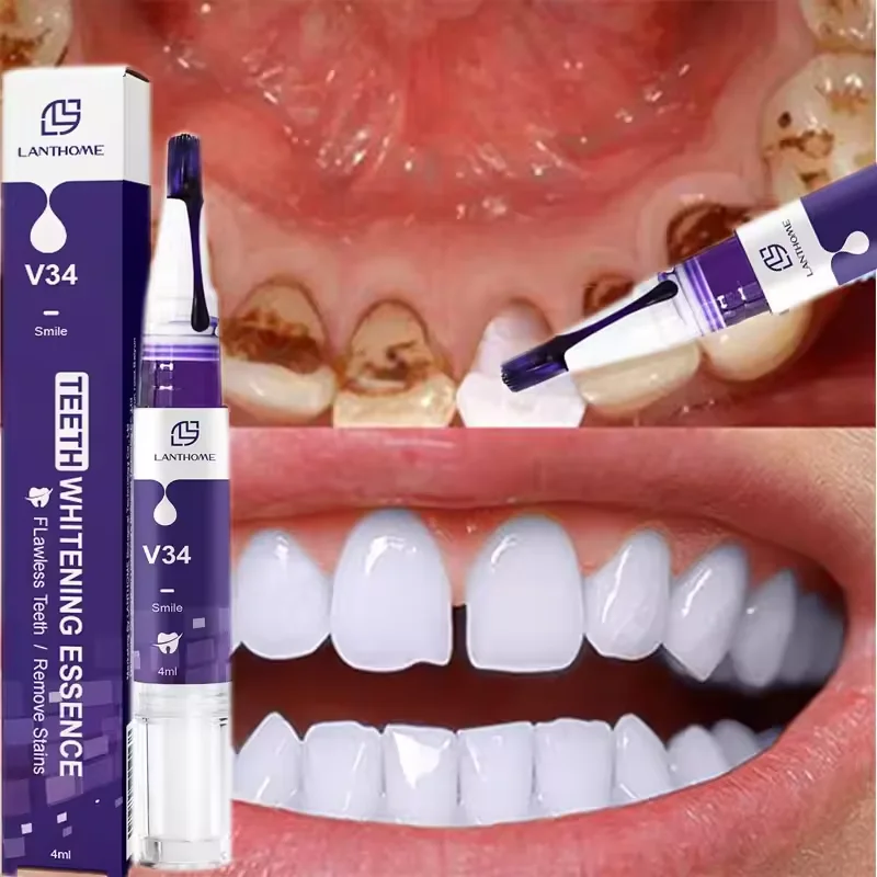 

Teeth Cleansing Whitening Toothpaste Whiten Gel Whitener Bleach Removes Stains Fresh Breath Tooth Cleaning Korea Products