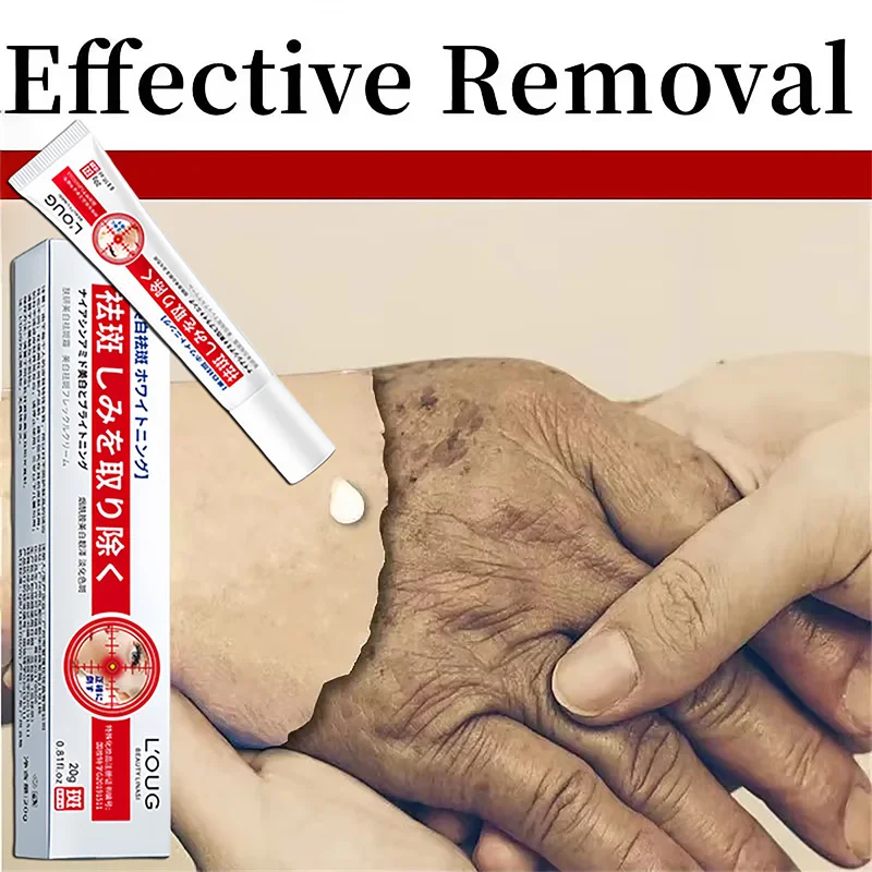 

Mild niacinamide whitening and blemish cream, lightens melanin dull pigment, moisturizes skin care