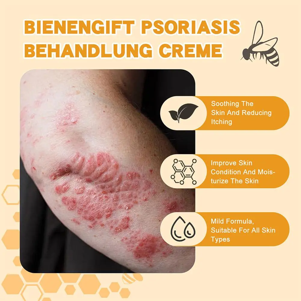 Профессиональный гель для лечения суставов, псориаза, прополиса, 30 г