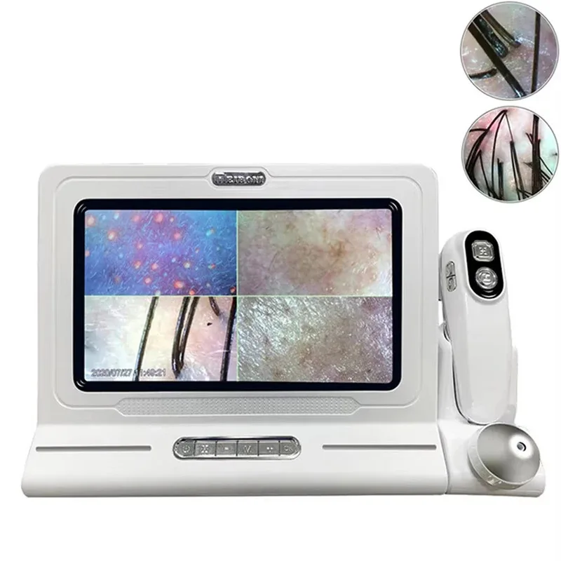 Professional 11 Inch Skin Hair Detector Scalp Hair Follicle Moisture Skin Pores Pigment Magnifying Analyzer Skin Pigment Tester