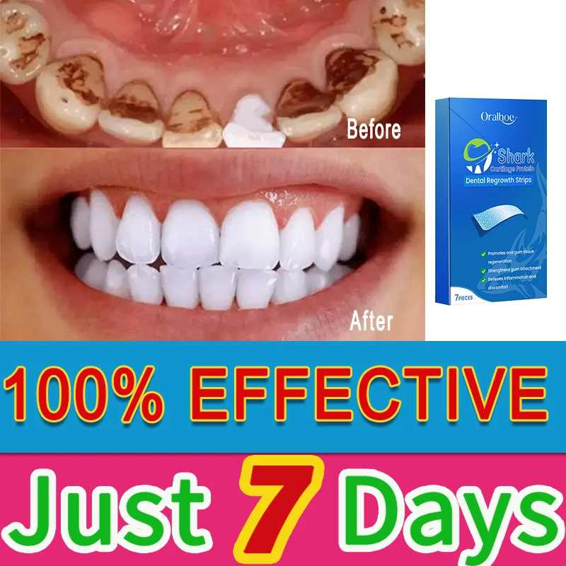 

Teeth Cleaning Removing Stains And Smoke Stains Teeth Whitening Yellowing Scaling Whitening Transparent Teeth Stickers Dentist