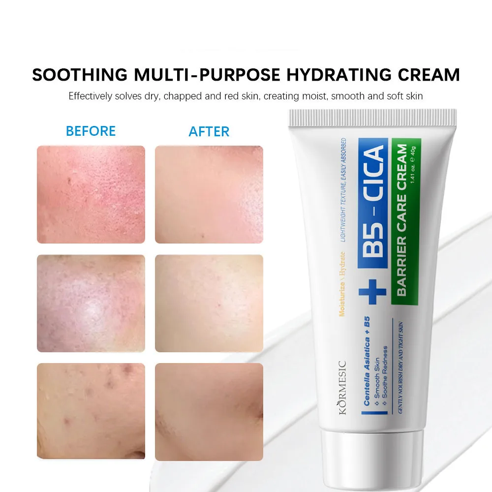 B5 Repair Cream 40g Moisturizing Hydrating Effectively Solves Dry Chapped And Red Skin Nourishes Improve Repair Redness Cream
