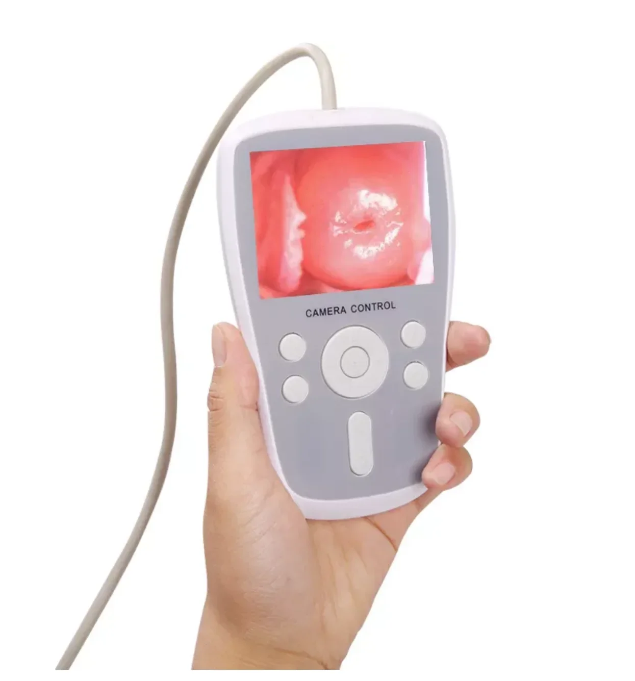 YD-220A Digital Handheld Direct-to-Screen Video Colposcopy mobile digital  Portable Digital  Vagina Video