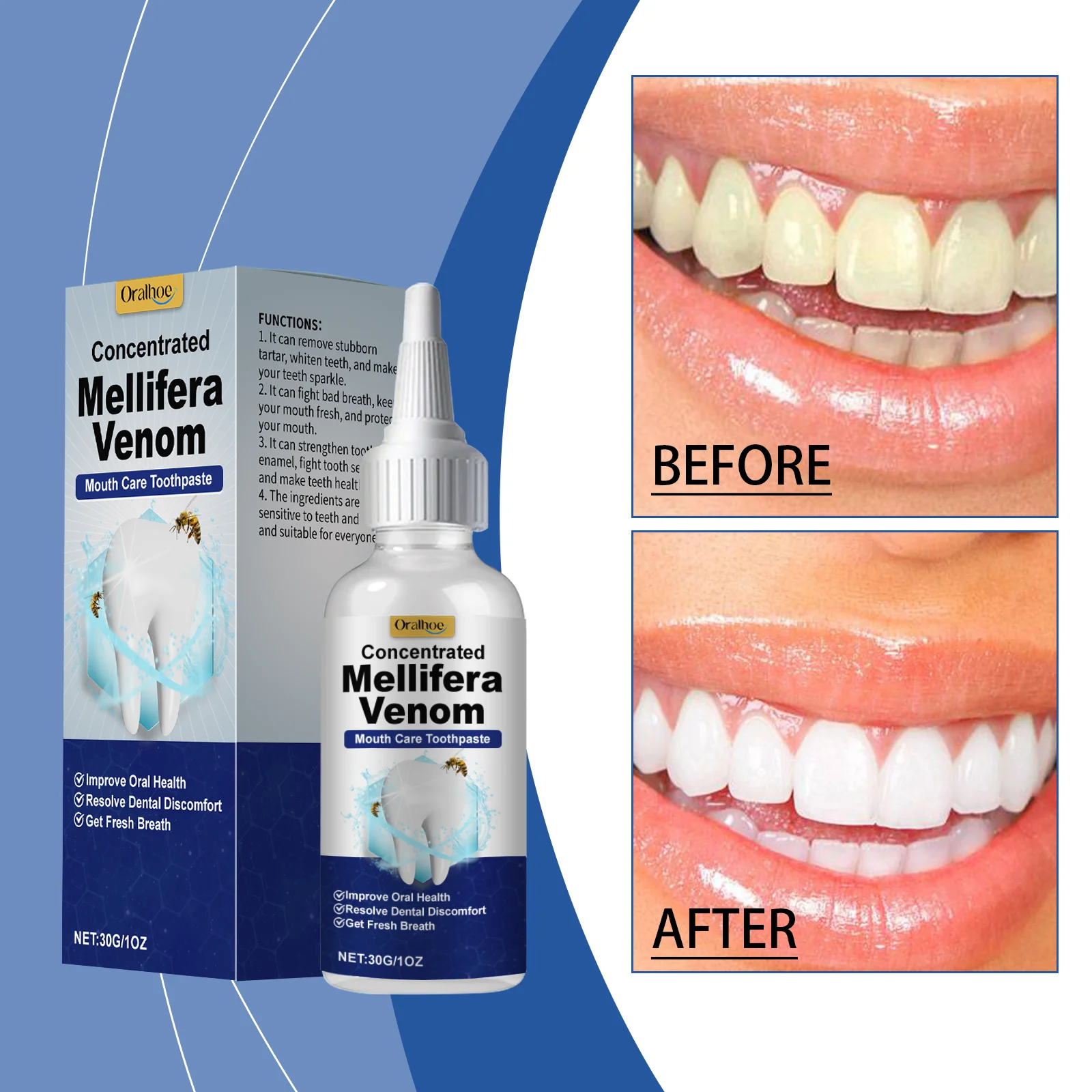 Hyaluronic Acid Toothpaste Effectively Removes Tartar, Cleans Oral Hygiene, Freshens Breath and Brightens Teeth Care Products