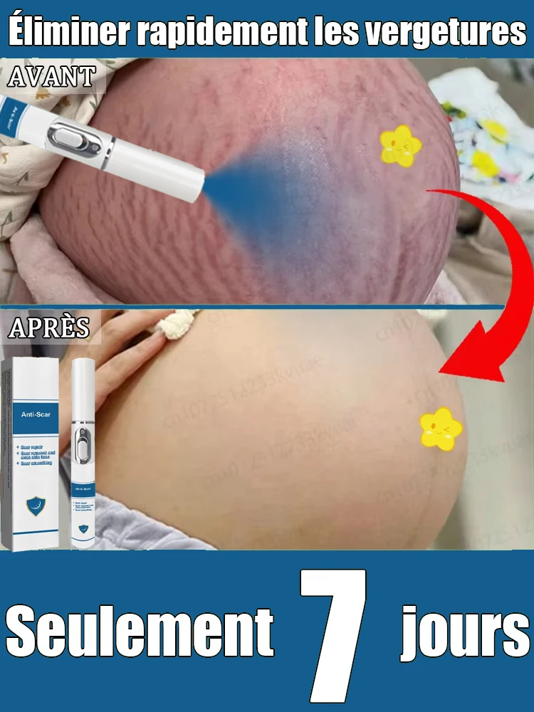 

Scar removal laser product. Effective for all scars