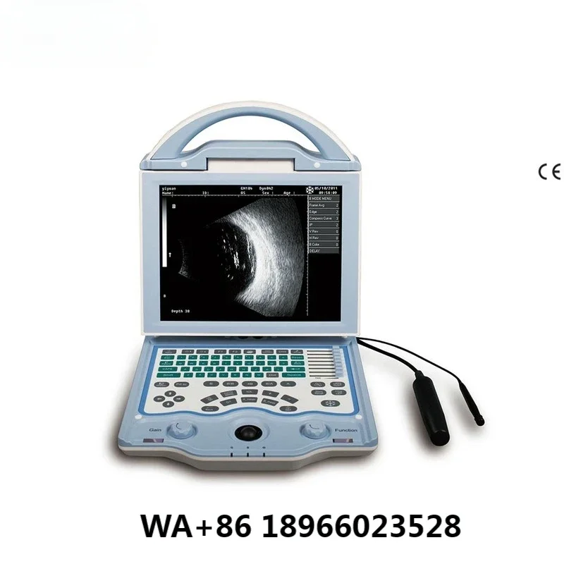 a/b scan ophthalmic ultrasound SUN-AB, ophthalmology, portable ophthalmic