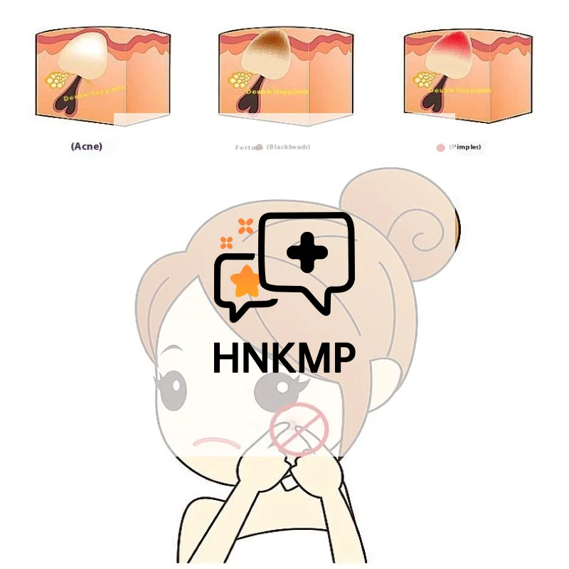 Acne Mee-eter Pincet 7-vormige Haak Clip Gezichtsschoonheid Verwijder Acne Naald Gereedschap Voor Huidverzorging