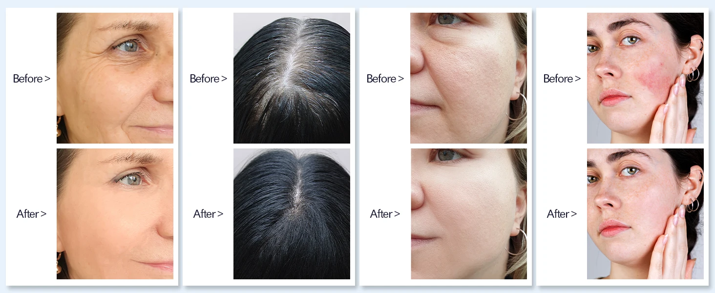Dermapen M8S-Patronen, 12/36PIN Microneedling-Patronen für A8S M8S A9 A11, Einweg-Ersatz-Microneedling-Nadeln – Detail 7