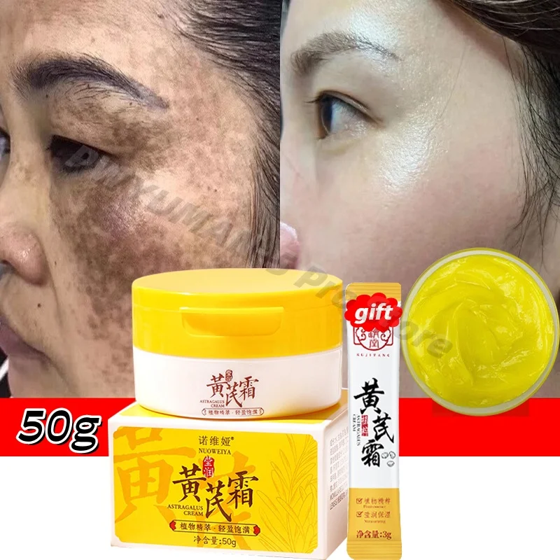 

Astragalus Whitening Freckles Face Cream Remove Dark Spots Melasma Lighten Melanin Acne Scars Anti-aging Brighten Skin Care 50g