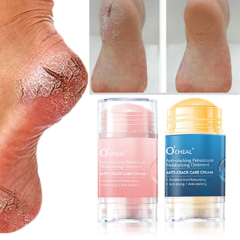 

Ocheal Body Skin Foot Care Cream Repair Heel Hand Leg Anti-drying Anti-wrinkle Moisturizing Cracked Exfoliating Soft Care Cream