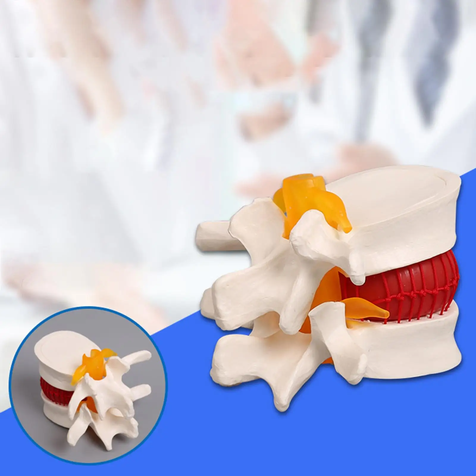 Human Disc Herniation Model Spine Model for Teaching School