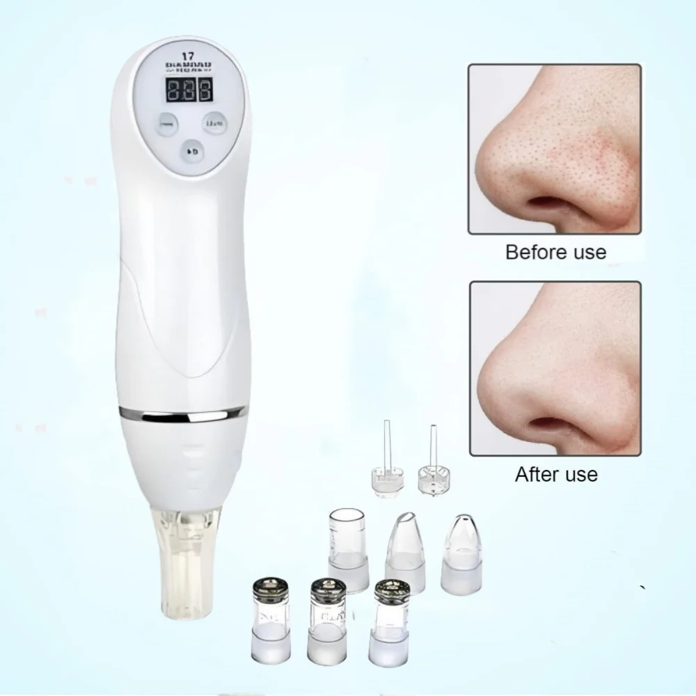 جهاز تقشير الجلد الماسي الصغير لتقشير الرؤوس السوداء، جهاز إزالة شفط الهواء، جهاز تجميل رقمي، منظف مسام الوجه