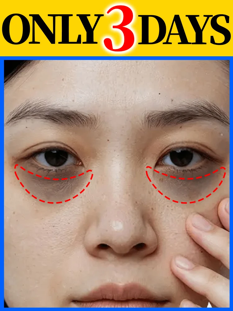 

Устранение корневой причины проблем с глазами.