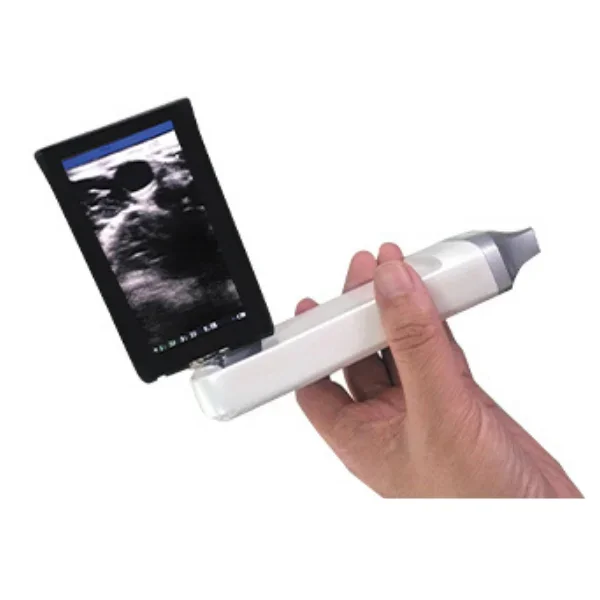 New Trend Hospital Clinic Use Black And White Built-in Screen Mini Portable Wireless Probe Ultrasound Scanner Machine