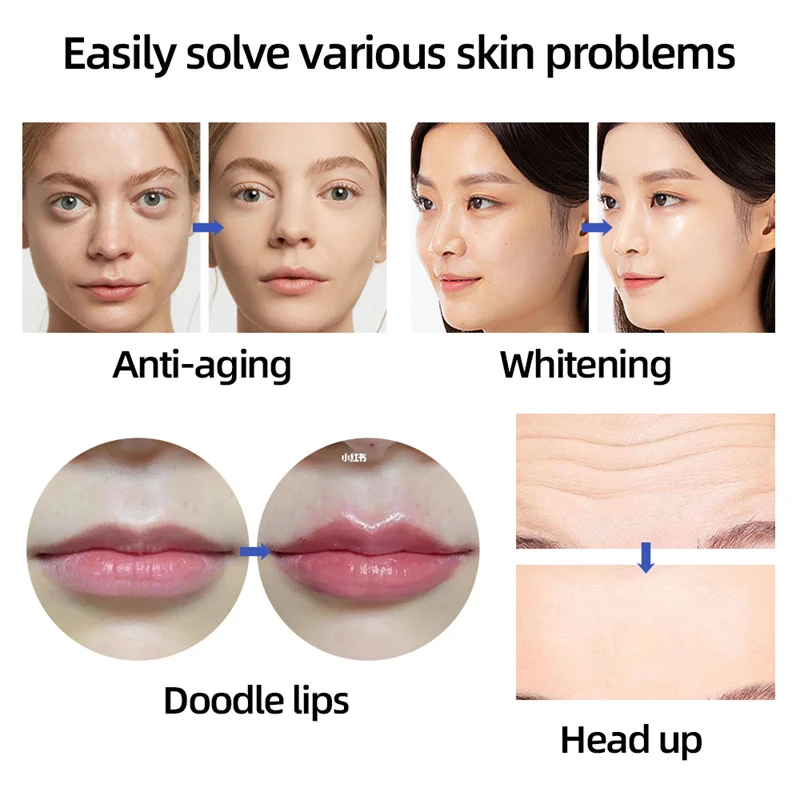 0.3/0.5ML Adjustable Pressure Pen Hyaluron Acid Pen Reduce Blemishes Wrinkles Thickening Lips Hyaluronic Acid Syringe Atomizer