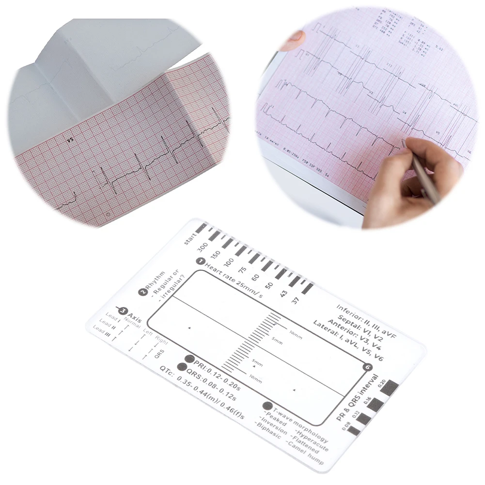 Ecg 7 Step Ruler Po…