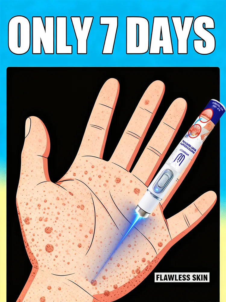 

Wart blue light tool Set Can says Goodbye ToFlat warts Filiform warts