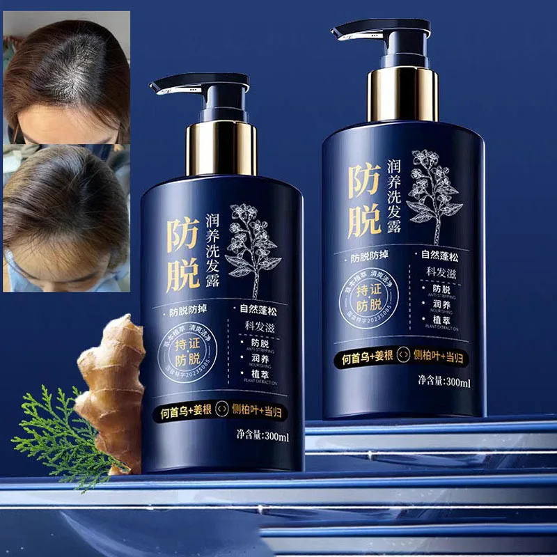 

Питательный шампунь против выпадения волос — для мужчин и женщин, стойкий естественный объем, против перхоти, нежное очищение, уход за волосами