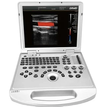 portable Color Doppler 2D general ob&gyn urology ultrasound DW-L3