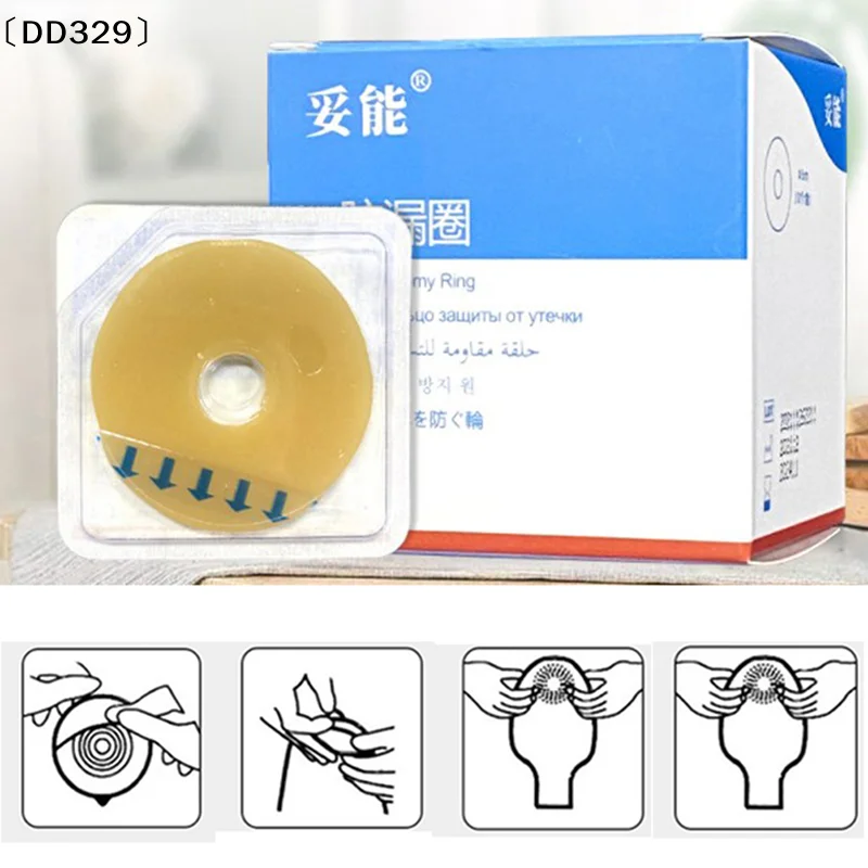10Pcs Ostomy Bag Paste Ring Baseplates Stoma Leakproof Ring Prevent Protect Skin〔DD329〕