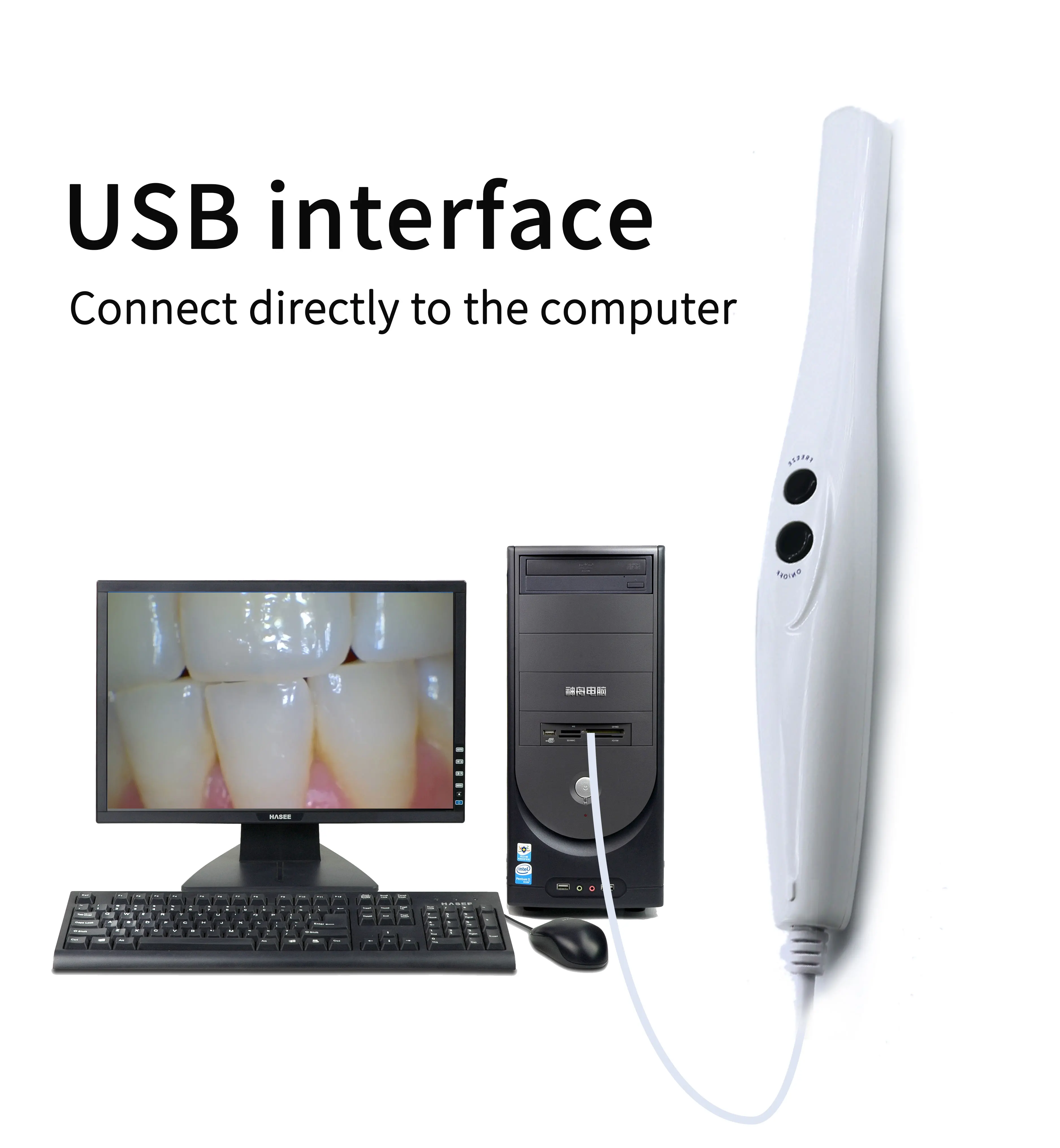 أفضل معدات العلاج عن طريق الفم في الولايات المتحدة الأمريكية 1080P HD مرايا الفم للأسنان USB ماسح ضوئي للكاميرا داخل الفم لكرسي الأسنان