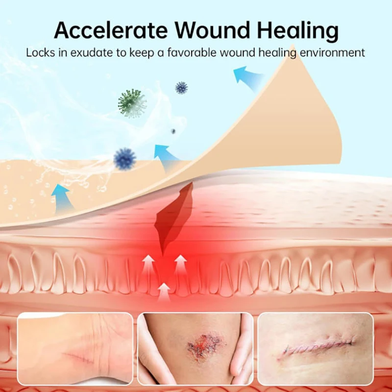 Hot! 1PC Hydrocolloid Roll For Wound Care Hydrocolloid Patch Bandages With Self-Adhesive, Bed Sore Bandages, Highly Absorbent view 3