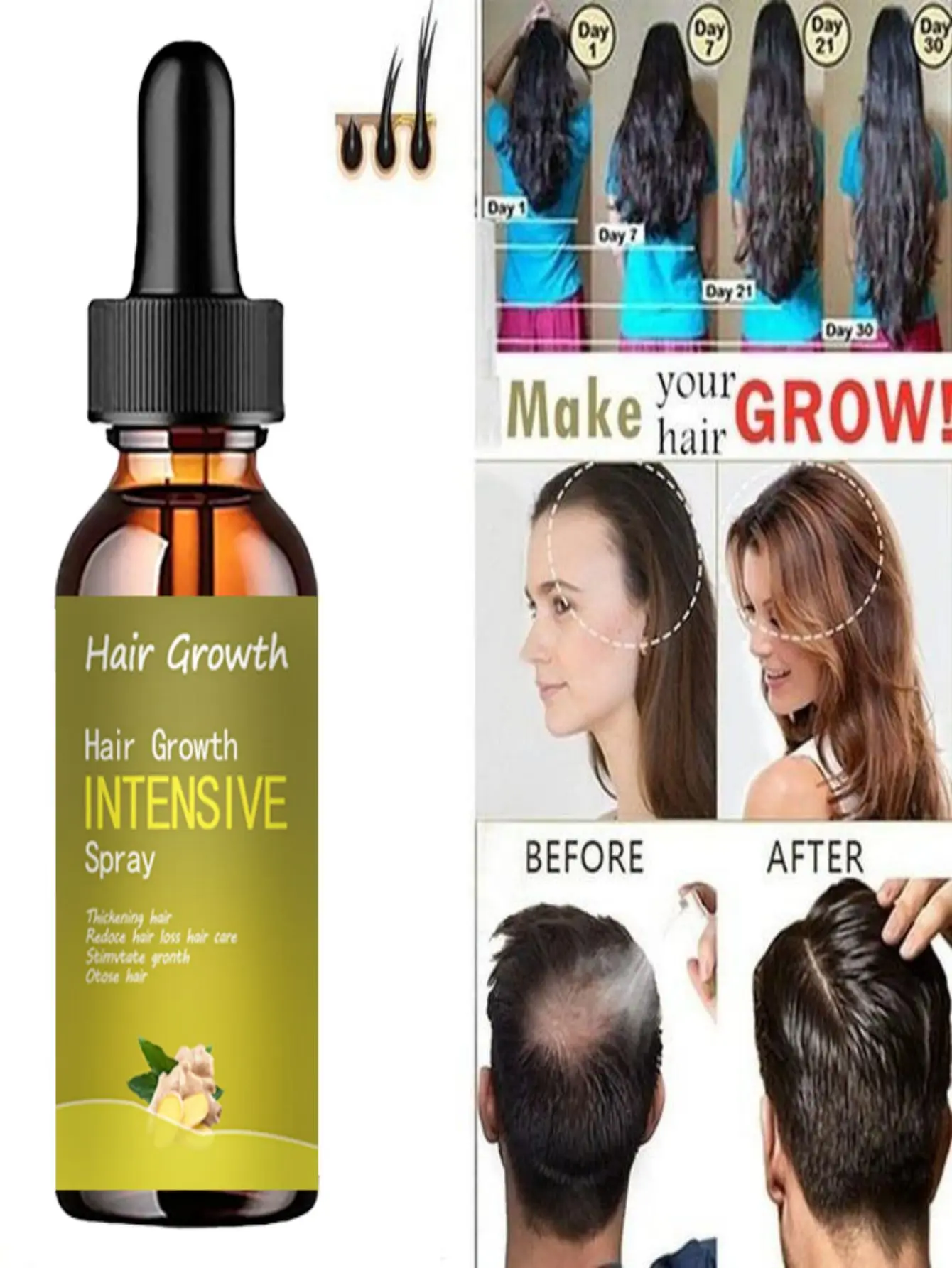 Ginger Hair Growth Essence Oils Products Anti Hair Loss Treatement Fast Growing Germinal Serum Prevent Scalp Damaged Men Women