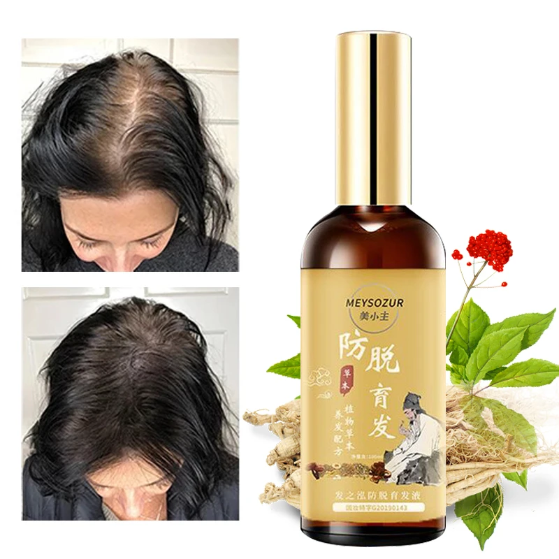 Hair Growth Serum Essential Liquid Prevent Hair Loss Beauty Repair Bifurcation Control Oil Relieve Itching Moisturizing 100ml