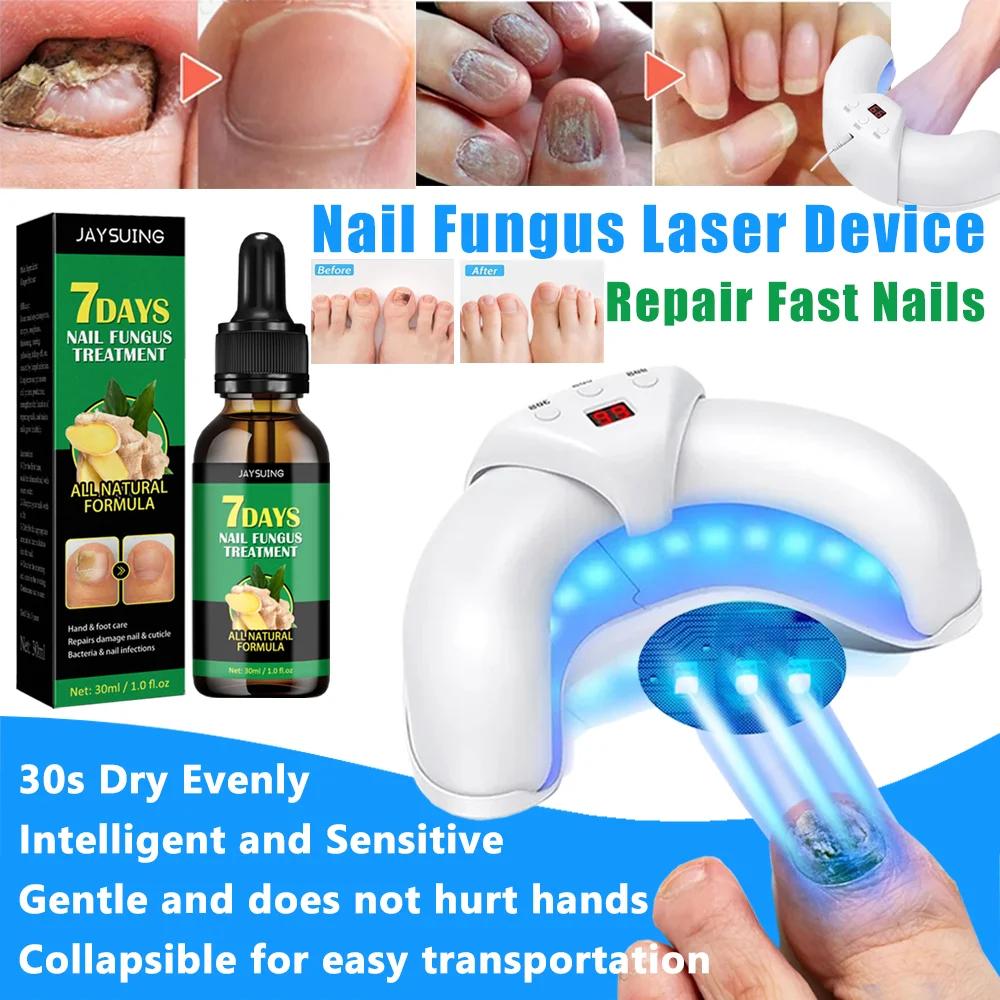 Tratamento fúngico Essência Nail Fungus, Onicomicose, Foot Care Tool, Laser Device, Fast Repair, Remove Nail Fungus