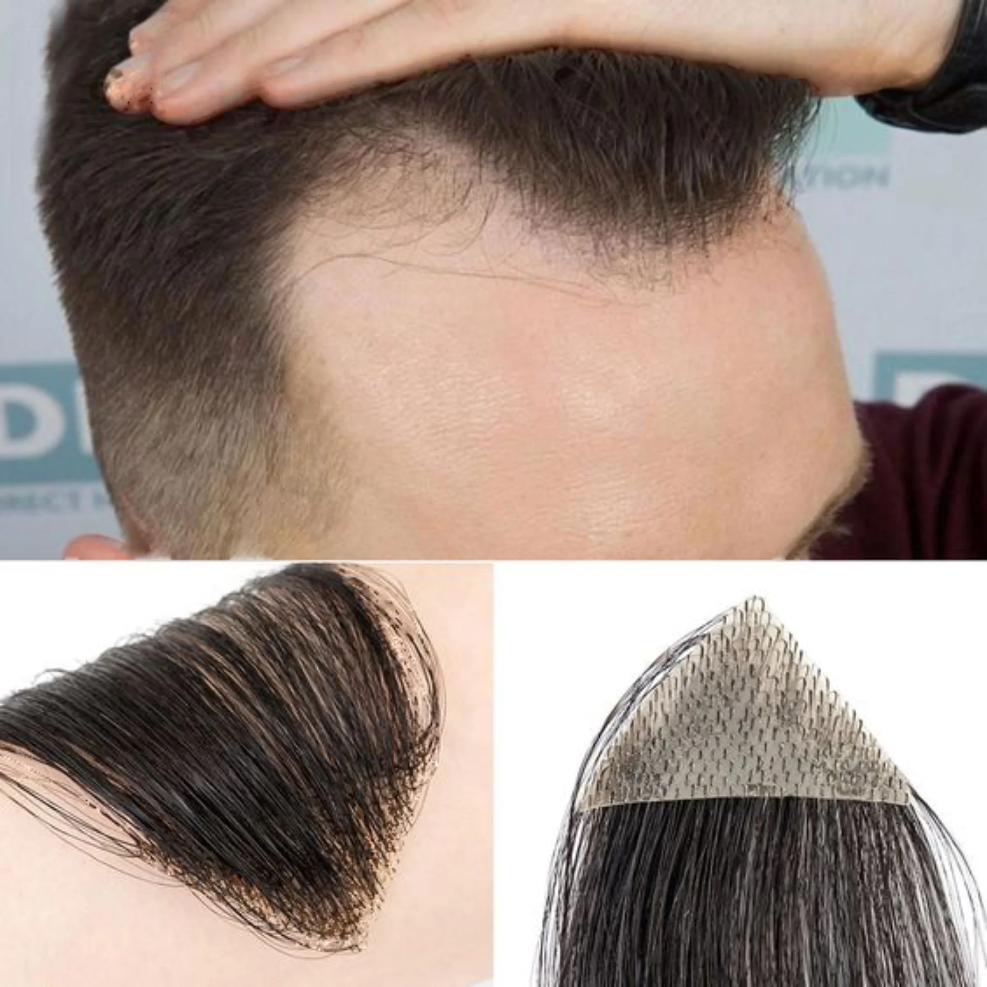 OCK 1 paar Menselijk Haar Vervanging Patch voor Mannen 15 cm Haarlijn Verlies Rechte Tape in Vervanging Toupetje